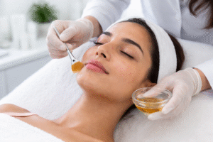 Chemical Peel Treatment Guide